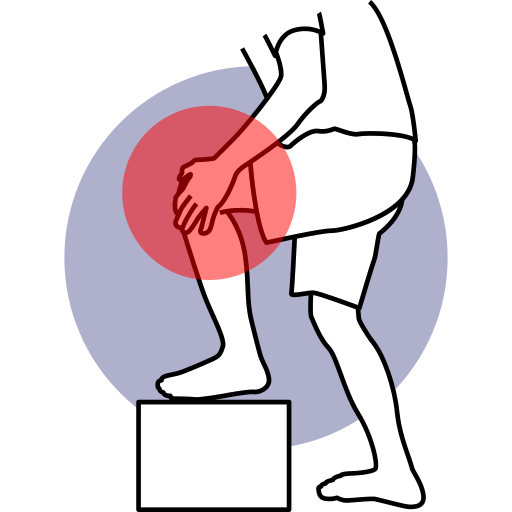 Rodilla